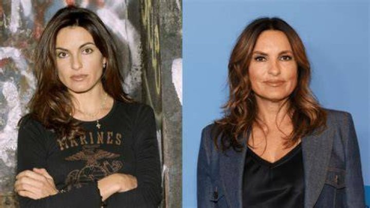 Mariska Hargitay Plastic Surgery