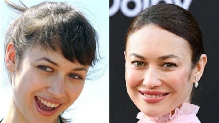 Olga Kurylenko Plastic Surgery Before and After